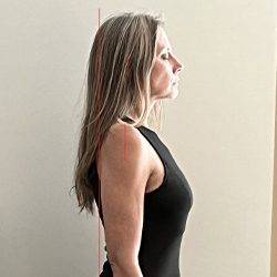 Chiropractic Saint Johns FL Posture Analysis